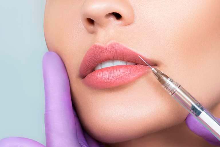 Aumento de labios en Salamanca realizado por Instituto Funaro